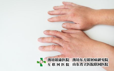 攝圖網(wǎng)_327119749_治療皮膚病 ??? 濕疹 皮炎 素質(zhì) 在人的手上 皮膚病學方向的醫(yī)學理念和治療（企業(yè)商用）
